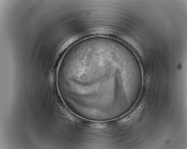 X0000098170874200805011011