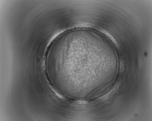 X0000098170878200805011011