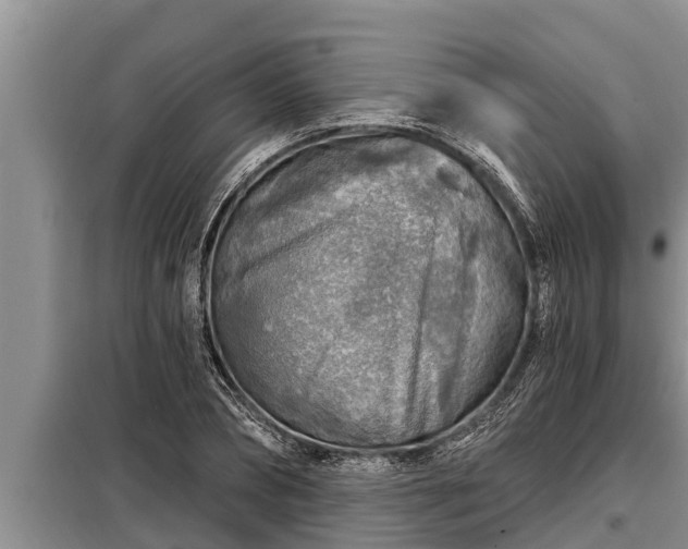 X0000098170882200805011011