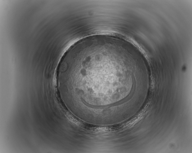 X0000098170883200805011011