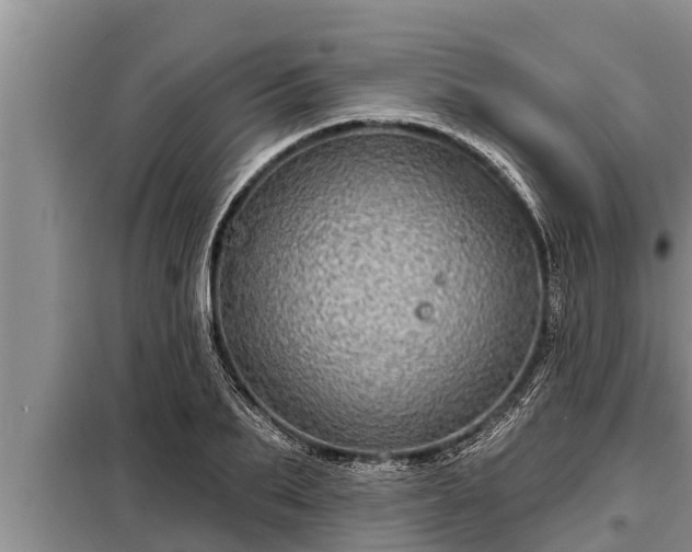 X0000098170887200805011011