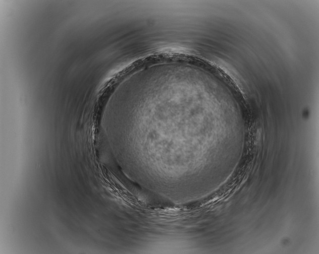 X0000098170919200805011010