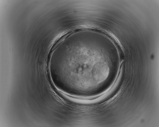 X0000098170930200805011010