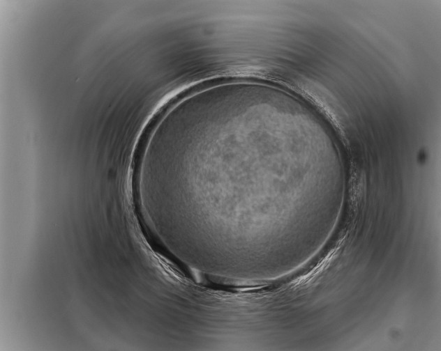 X0000098170932200805011011