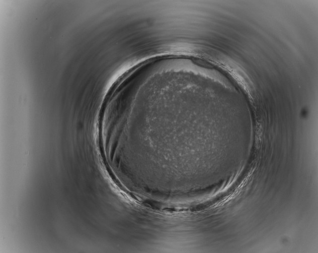 X0000098170944200805011011