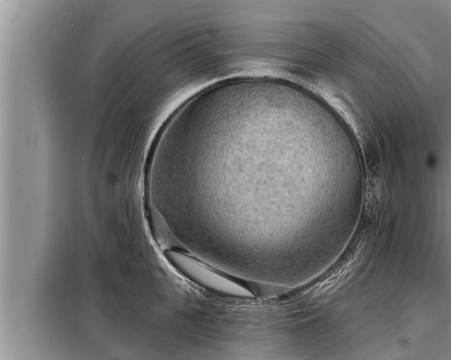 X0000098170951200805011011