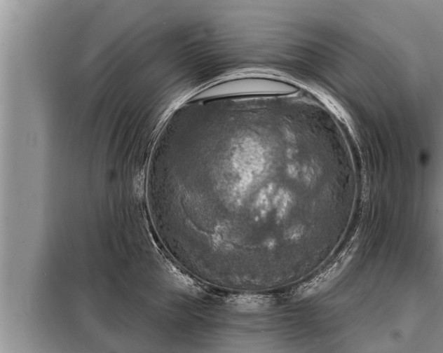 X0000098170953200805011011