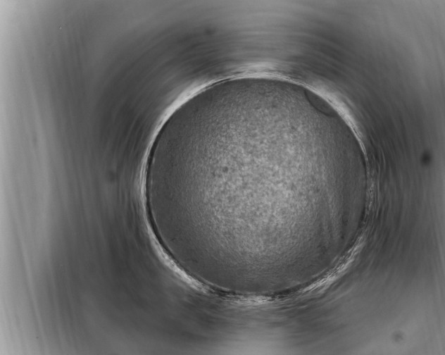 X0000098170957200805011011