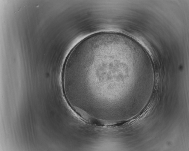 X0000098170959200805011011