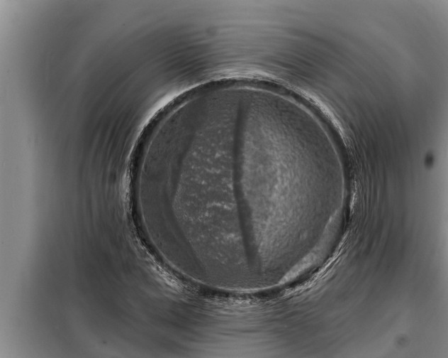 X0000098170975200805011010