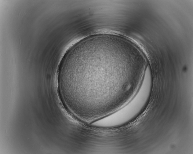 X0000098170987200805011010