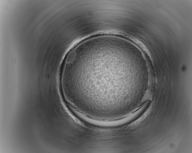 X0000098170989200805011010