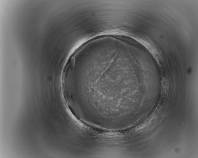 X0000098170998200805011009