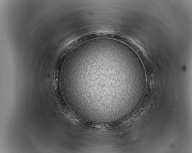 X0000098171015200805011009