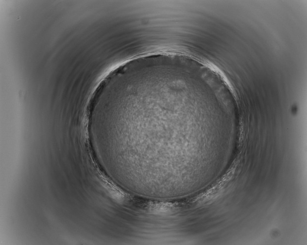 X0000098171019200805011009