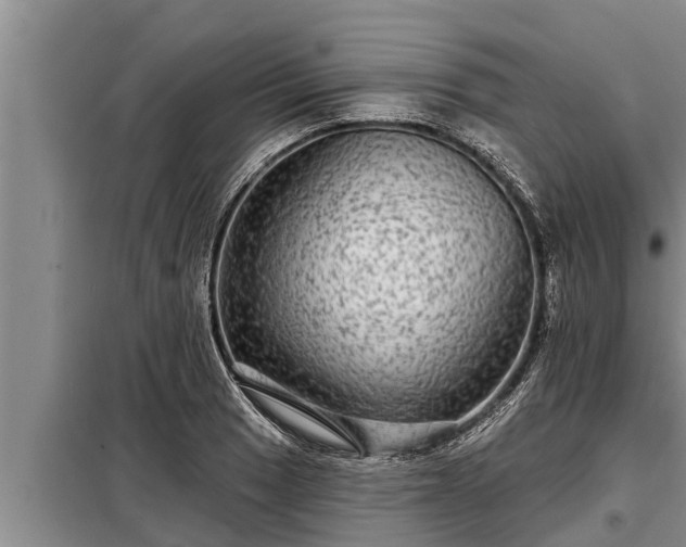 X0000098171033200805011009