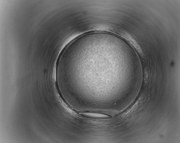 X0000098171036200805011009