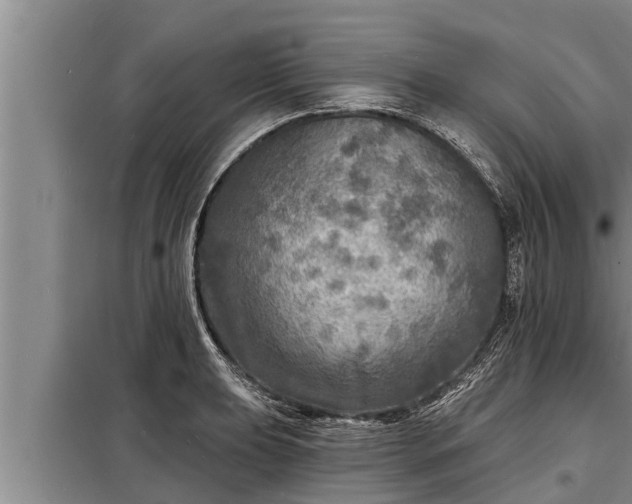 X0000098171039200805011009