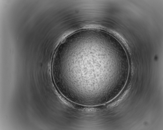 X0000098171041200805011009