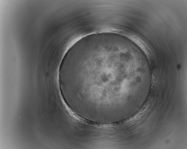 X0000098171047200805011009