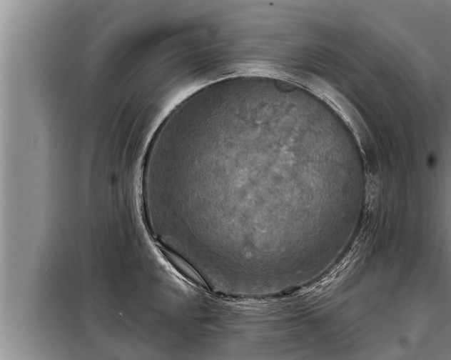 X0000098171048200805011009