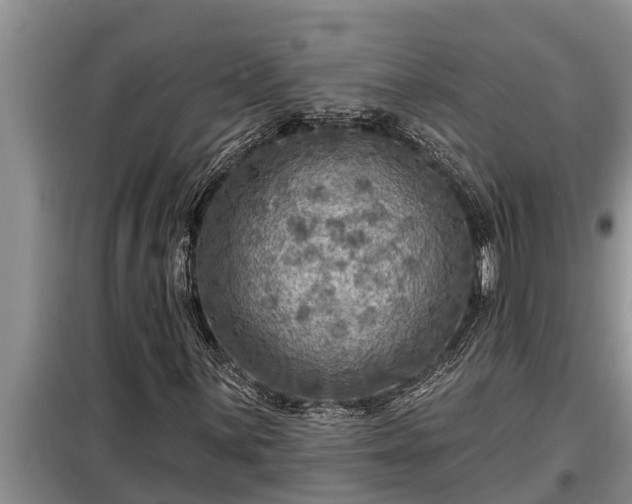 X0000098171059200805011009