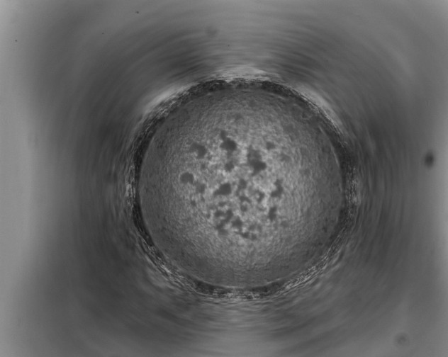 X0000098171063200805011009