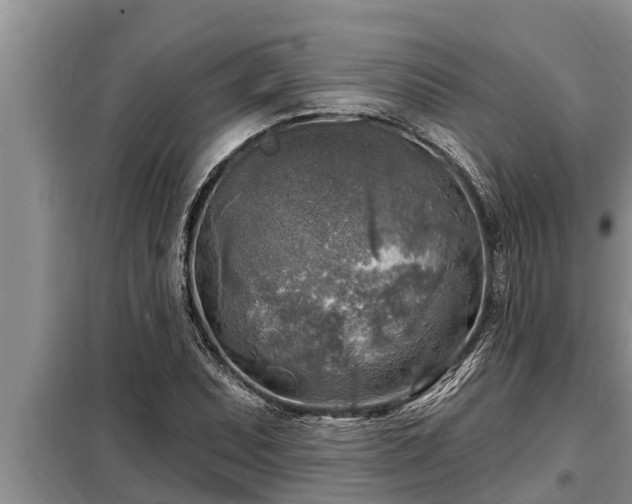 X0000098171071200805011008