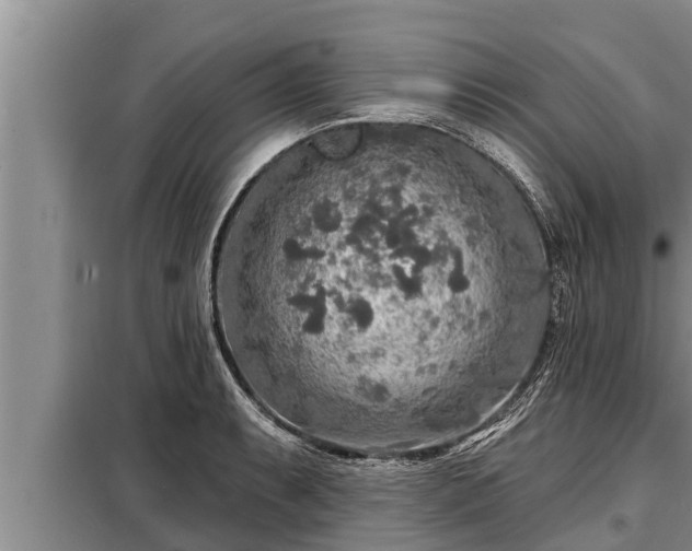 X0000098171087200805011008