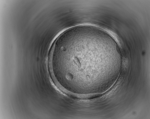 X0000098171100200805011008