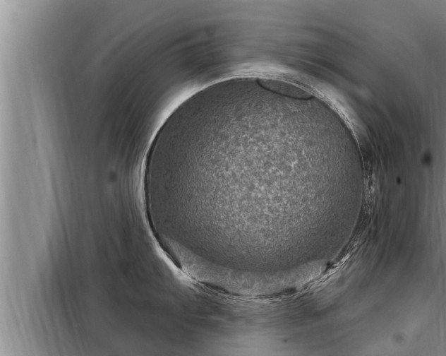 X0000098171103200805011008