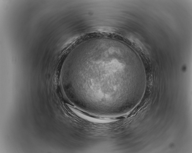 X0000098171110200805011007