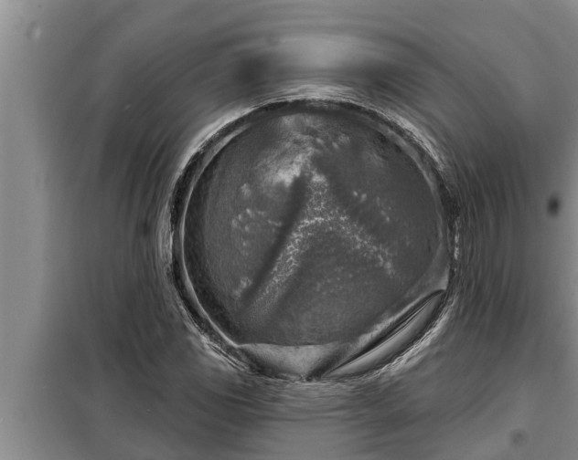 X0000098171117200805011007