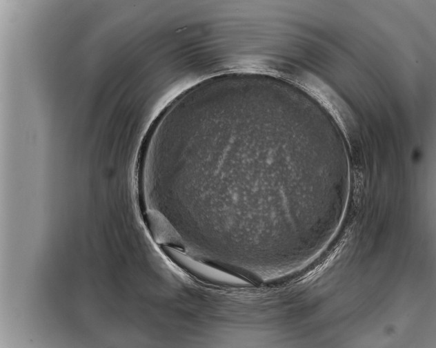 X0000098171141200805011008