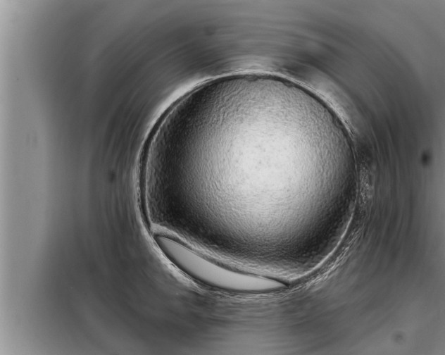 X0000098171142200805011008