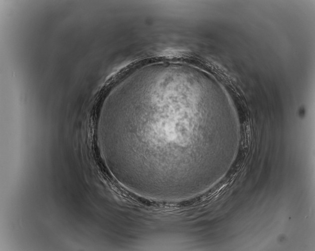 X0000098171158200805011007