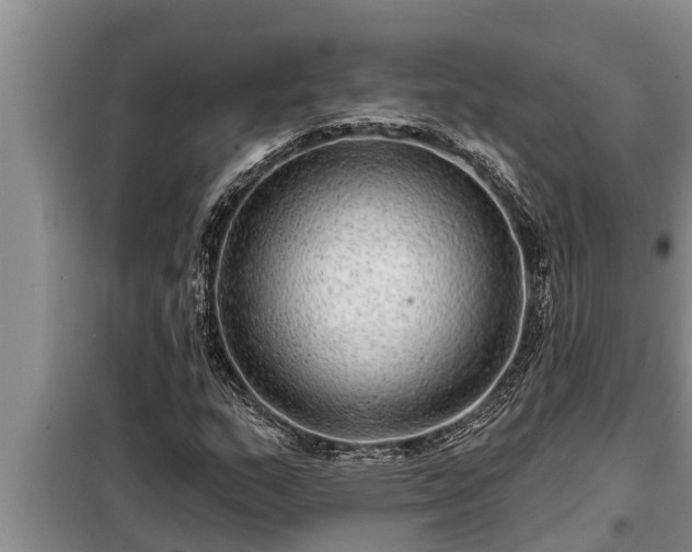 X0000098171159200805011007