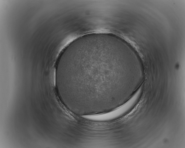 X0000098171171200805011007