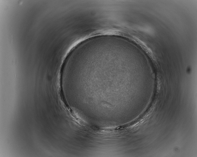 X0000098171174200805011007