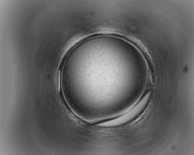 X0000098171175200805011007