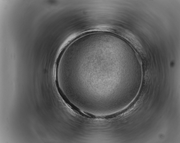 X0000098171180200805011007