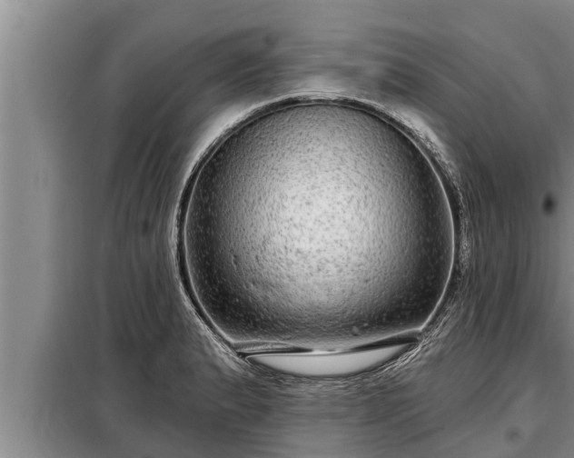 X0000098171183200805011007