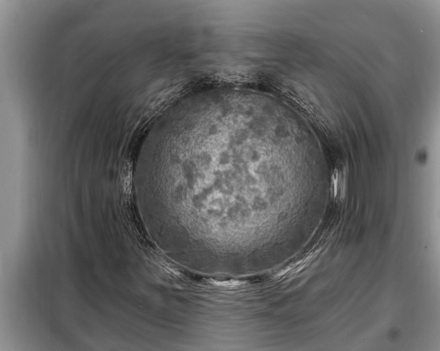 X0000098171251200805011006