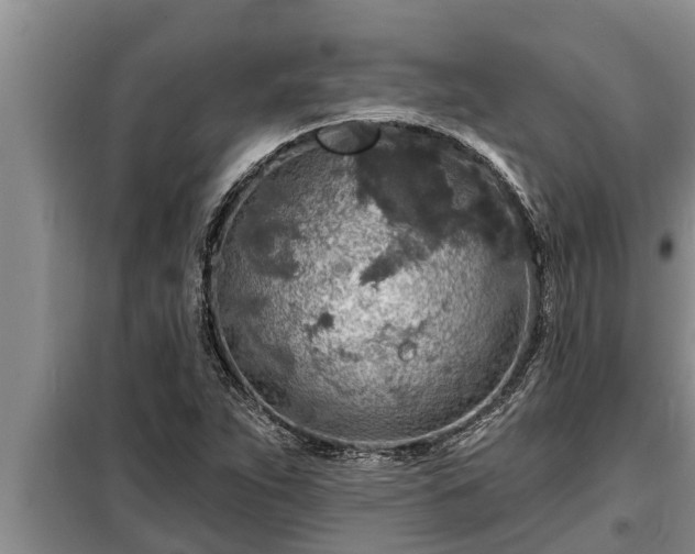 X0000098171263200805011005