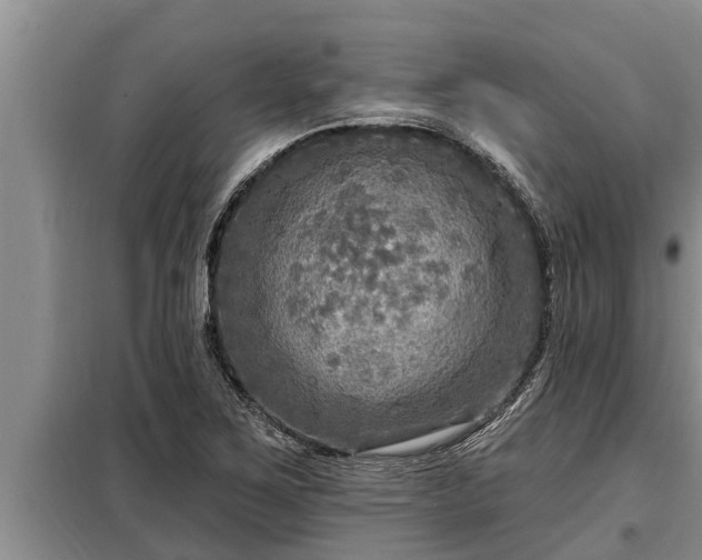 X0000098171267200805011005