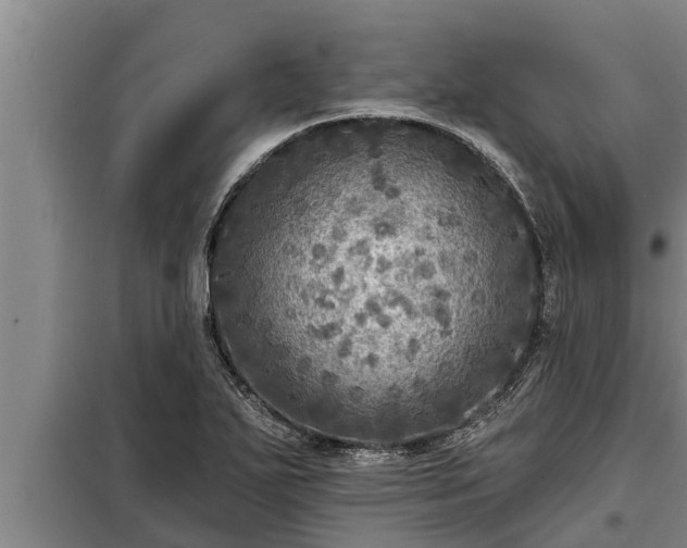 X0000098171271200805011005