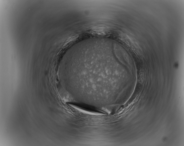 X0000098171297200805011004