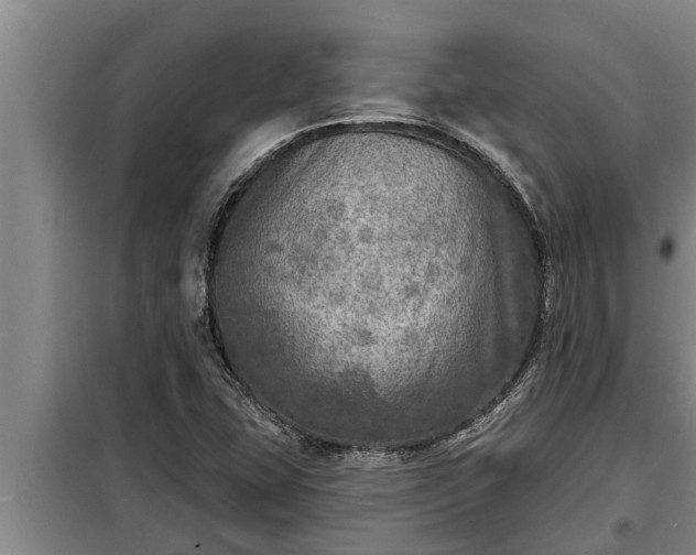 X0000098171407200805011003