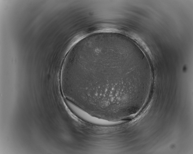 X0000098171425200805011003