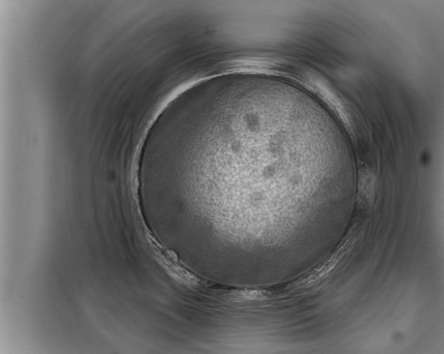 X0000098171435200805011003